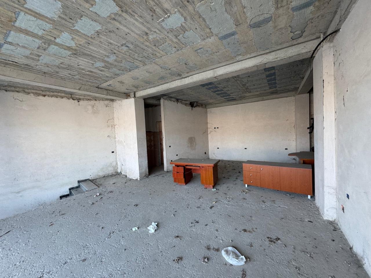 NJESI PER SHITJE PRANE SPITALIT!