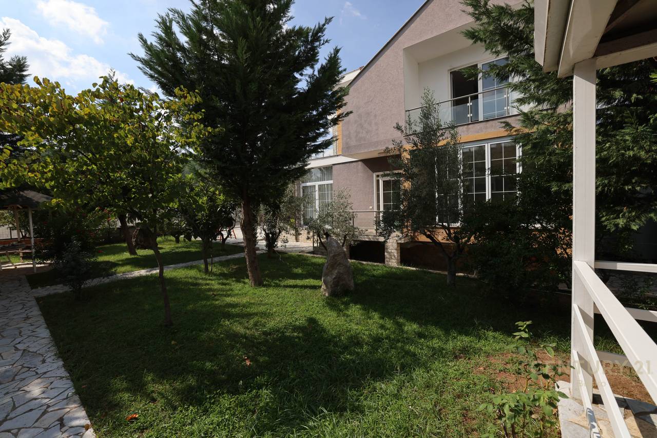 ✅ SHITET SUPER VILE PRANE FONDACIONIT FUNDJAVE NDRYSHE  ✅